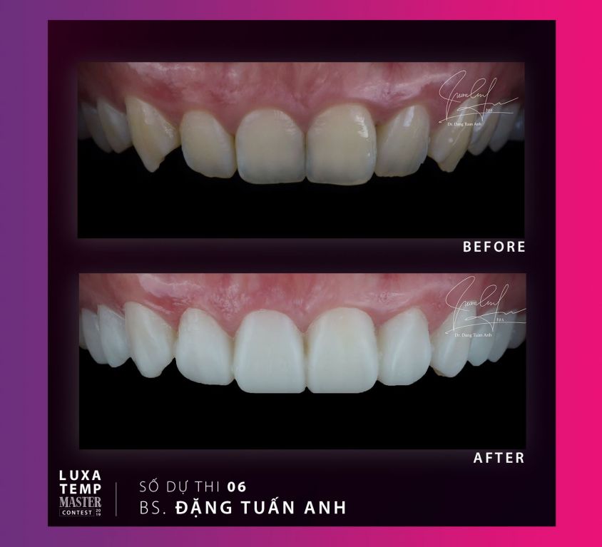 Case 02 – Dr. Đặng Tuấn Anh