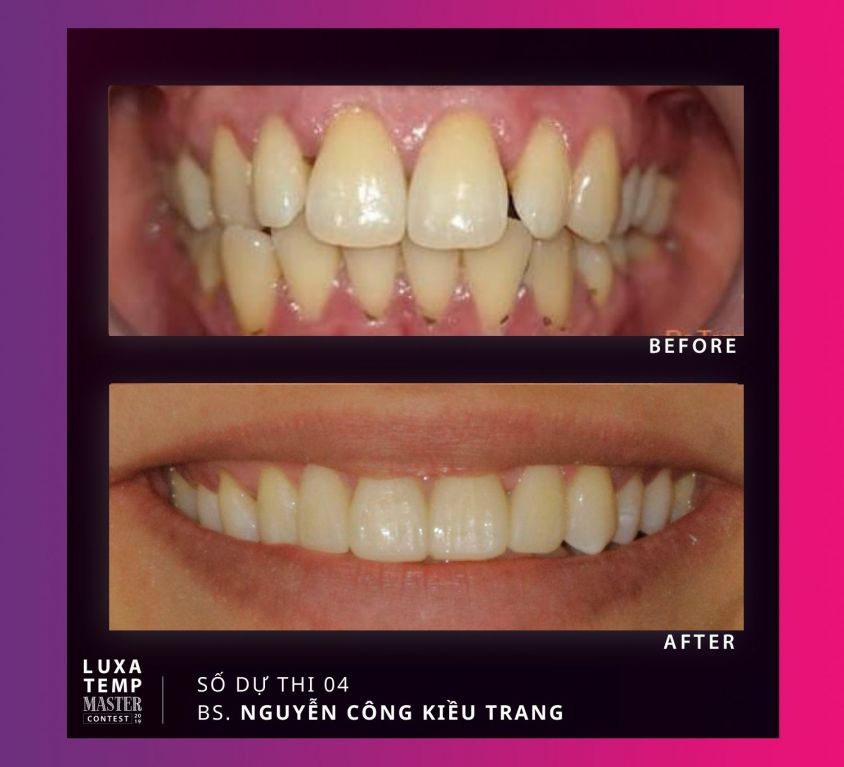 Case 04 – Dr. Nguyễn Công Kiều Trang