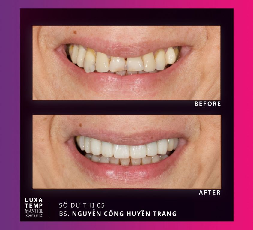 Case 05 – Dr. Nguyễn Công Huyền Trang