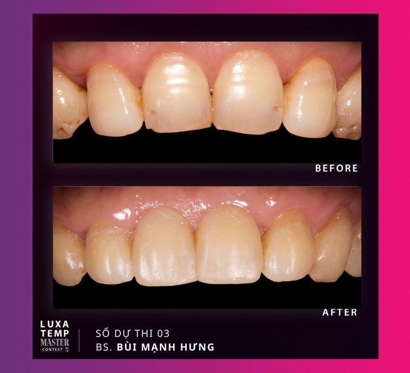 Case 03 – DR. Bùi Mạnh Hưng